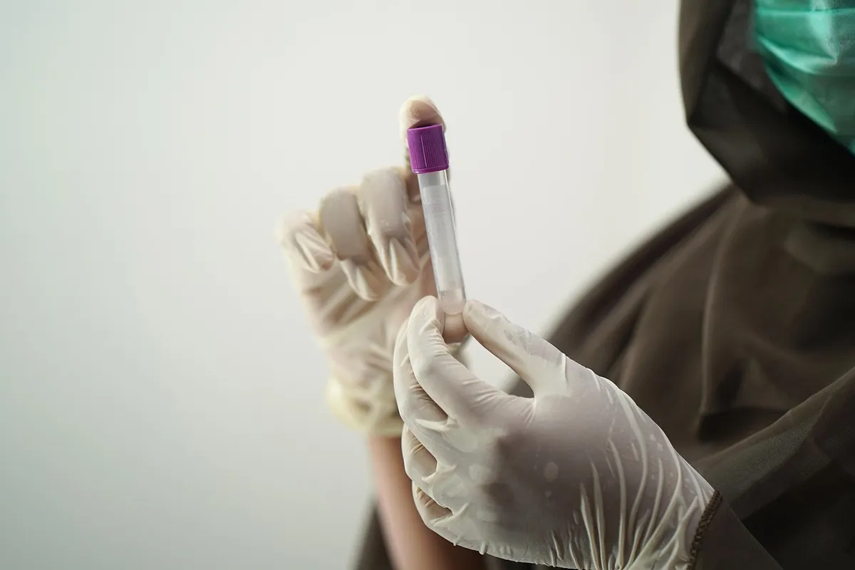 blood test, blood sample, medical technology, medical technologist, surgical gloves, face mask, sample, hospital worker, laboratory, lab, blood test, blood test