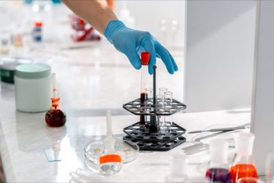 Medisch laborant: Beste tips voor een carrière in het lab
