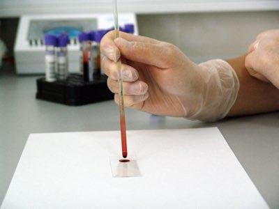 醫檢師的影響力指南：數據支撐70%臨床決策的職責分析